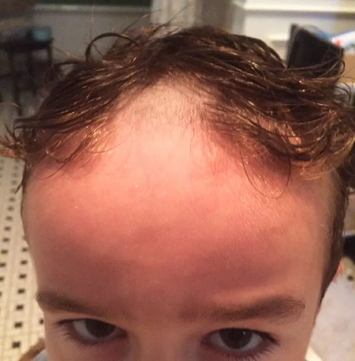 Before Bedtime One Night, After He Turned Off His Electric Tooth Brush, From The Other Room We Heard A Different Buzzing And Realized Too Late That Our 5yr Old Found My Husband's Beard Trimmer