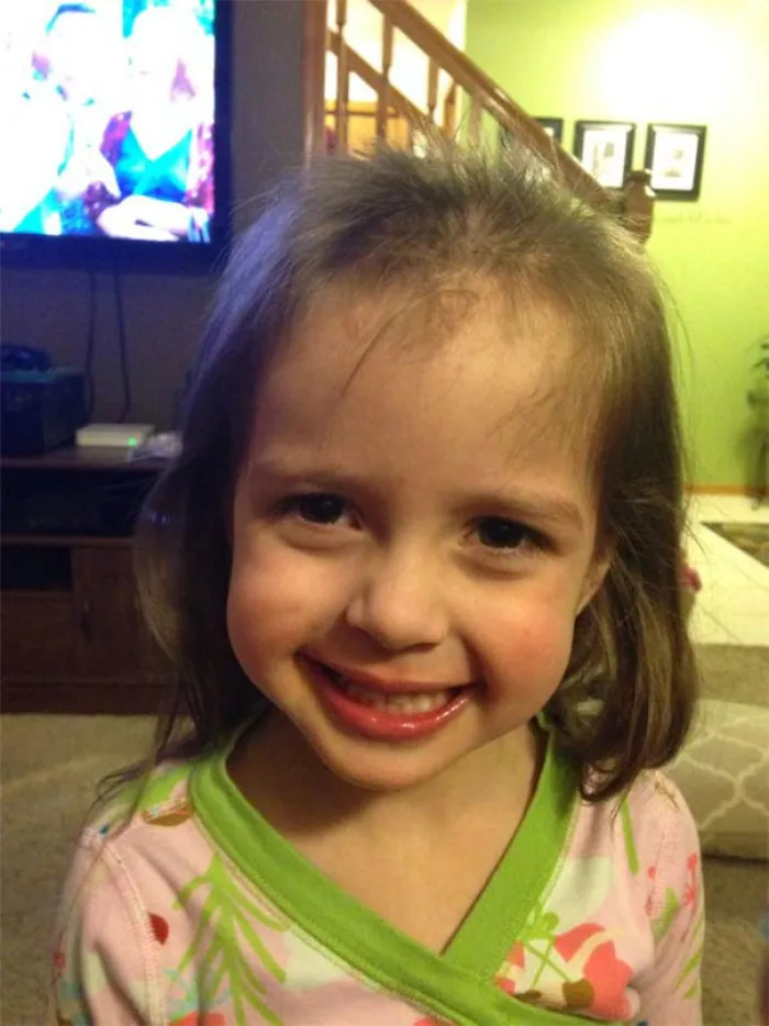 A child smiling after cutting their own hair, showing uneven bangs and missing patches.