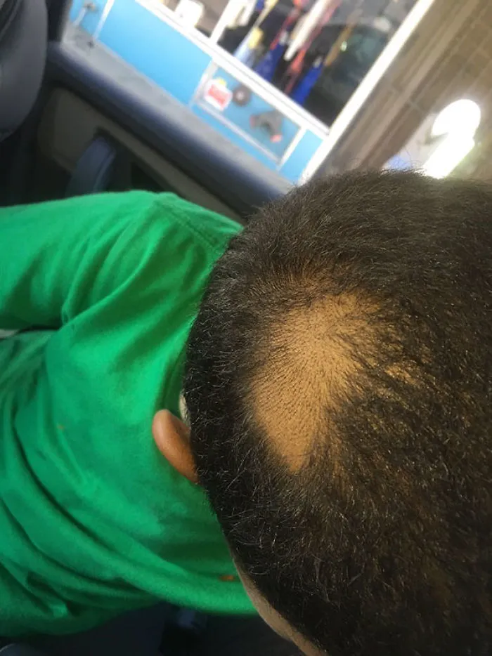 Child with a self-inflicted haircut featuring a large bald spot on top, wearing a green shirt.