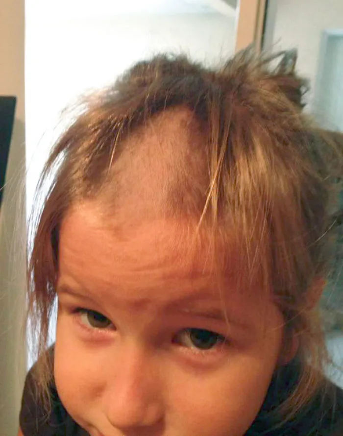 Child with a self-cut hairstyle looking regretful, highlighting kids experimenting with their own haircuts.