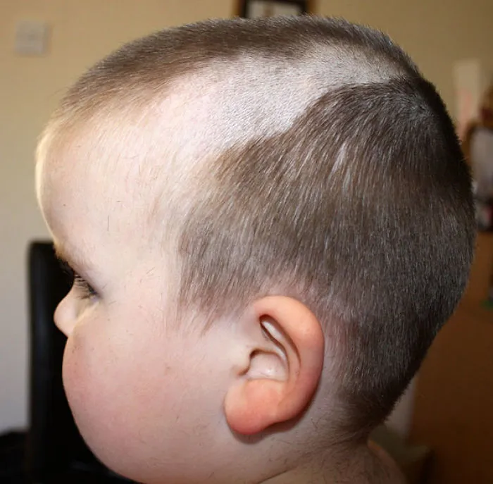 Child with a self-inflicted haircut showing unevenly shaved sections and short hair on the sides.