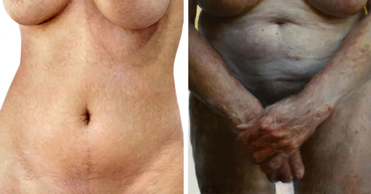 Estos elocuentes retratos muestran el aspecto de la gente real sin ropa (NSFW)