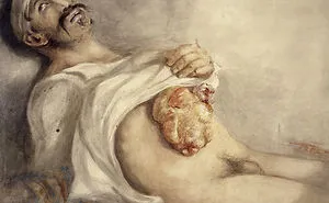 The Gruesome Artistic Talent Of Sir Charles Bell