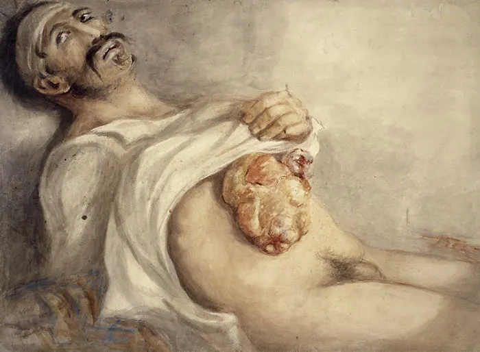 The Gruesome Artistic Talent Of Sir Charles Bell