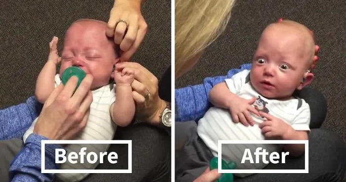 Baby Hears Mom For The First Time After Receiving Hearing Aids, And His Reaction Will Melt Your Heart