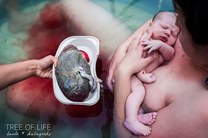 Birth In Colour