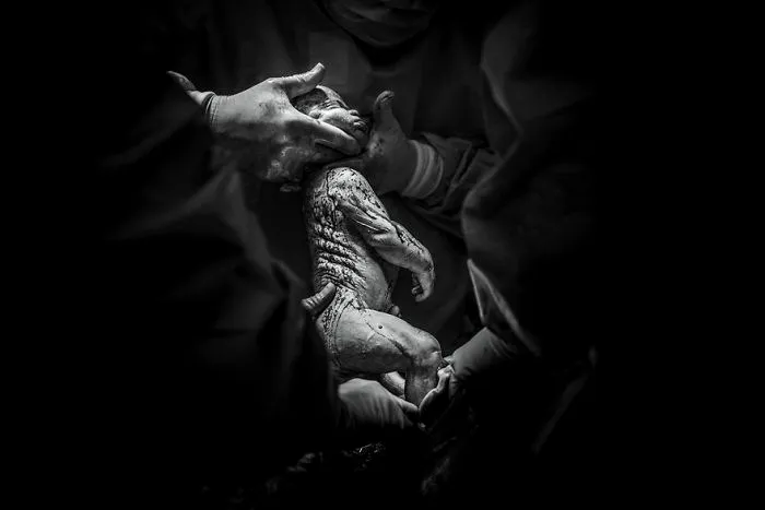 Mención De Honor - 17 Años De Espera: Un Milagro Sin Fertilidad
