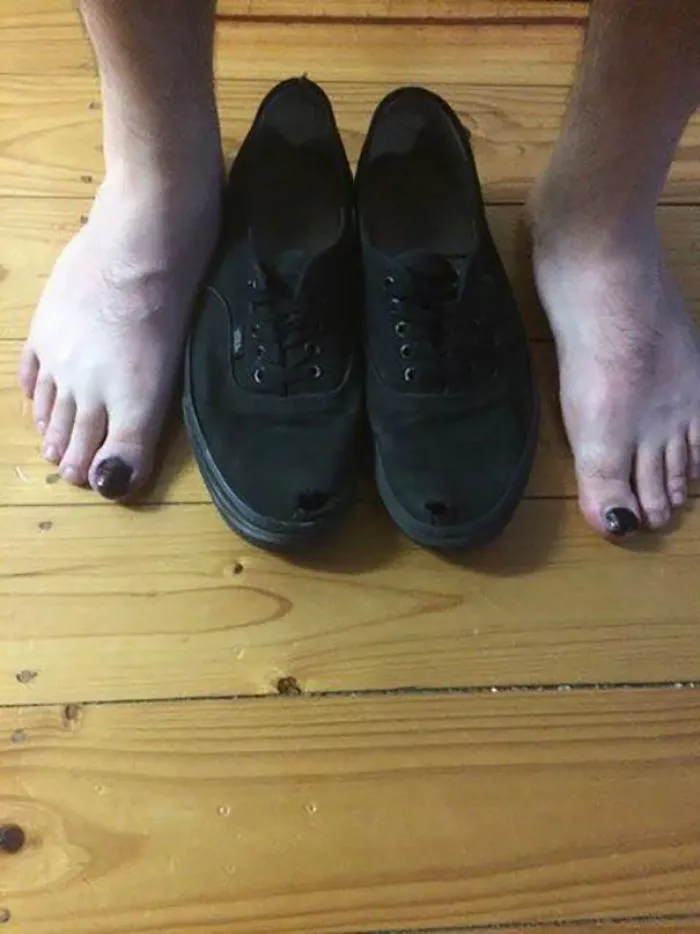 Use This Life Hack And No One Will Know There Are Holes In Your Shoes