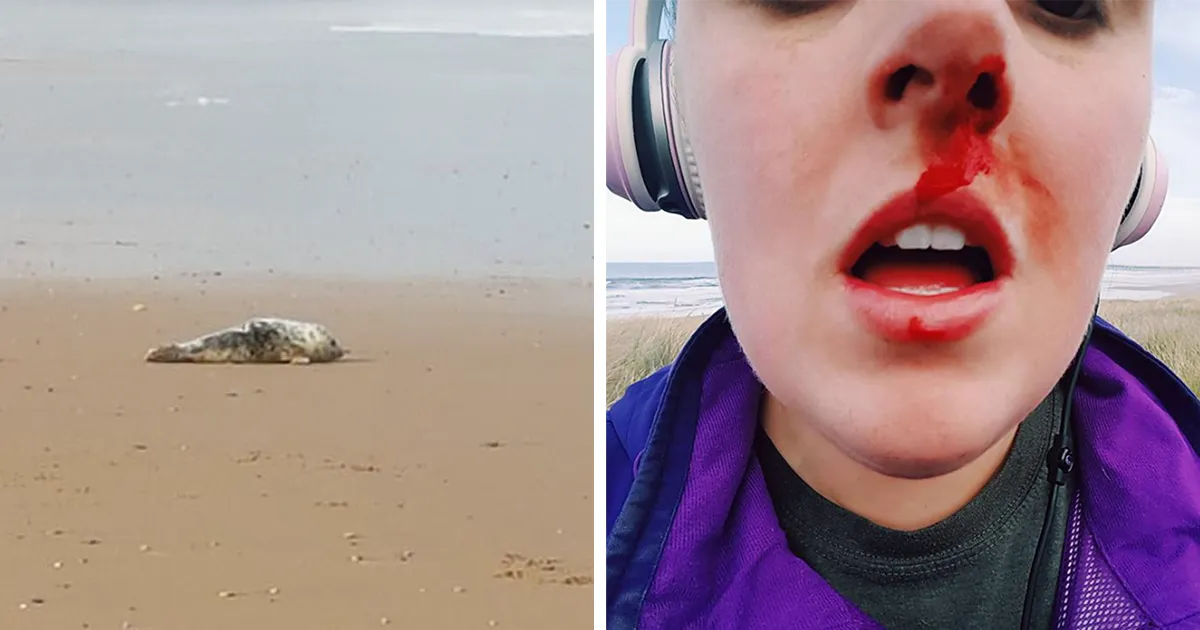 Esta mujer se enfrentó a unos adolescentes que torturaban a una cría de foca, y estos la golpearon en la cara
