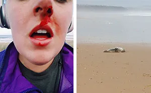 Woman Confronts Teenagers Torturing A Baby Seal, Gets Punched In The Face
