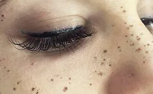 Tattooing Freckles On Your Face Is The New Beauty Craze, And They Look Surprisingly Beautiful