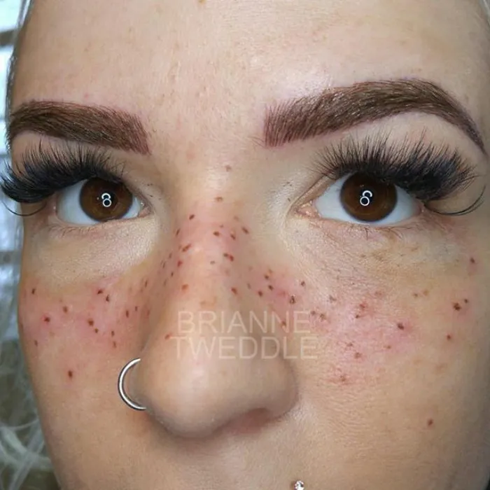 Tattooing Freckles On Your Face Is The New Beauty Craze, And They Look Surprisingly Beautiful
