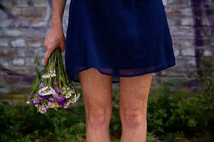 The Freckled Legs Of A Girl From Budapest