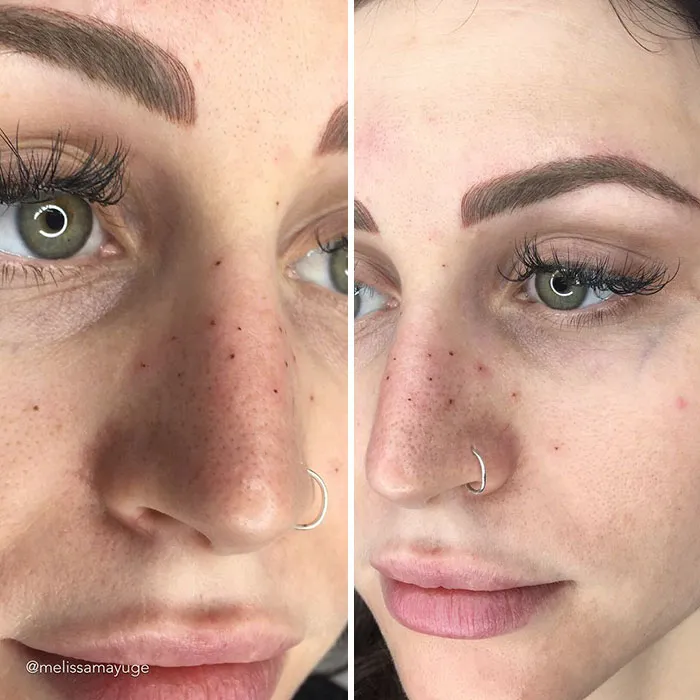 Tattooing Freckles On Your Face Is The New Beauty Craze, And They Look Surprisingly Beautiful