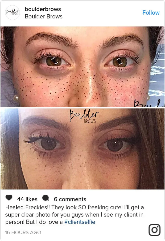 Tattooing Freckles On Your Face Is The New Beauty Craze, And They Look Surprisingly Beautiful