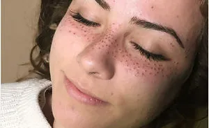 Tattooing Freckles On Your Face Is The New Beauty Craze, And They Look Surprisingly Beautiful