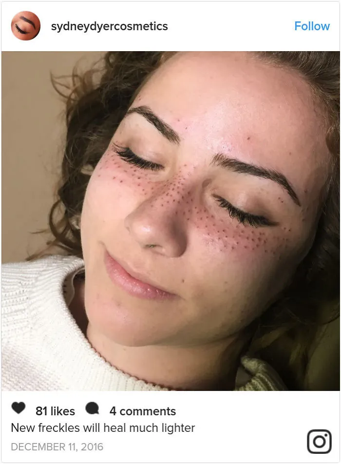 Tattooing Freckles On Your Face Is The New Beauty Craze, And They Look Surprisingly Beautiful