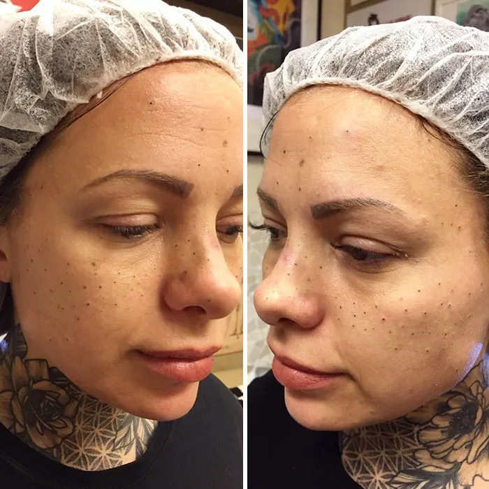 Tattooing Freckles On Your Face Is The New Beauty Craze, And They Look Surprisingly Beautiful