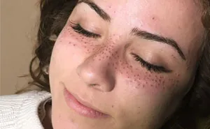 Tattooing Freckles On Your Face Is The New Beauty Craze, And They Look Surprisingly Beautiful