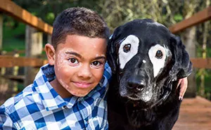 Boy With A Rare Skin Disorder Hates His Looks, Until He Meets His Dog Twin