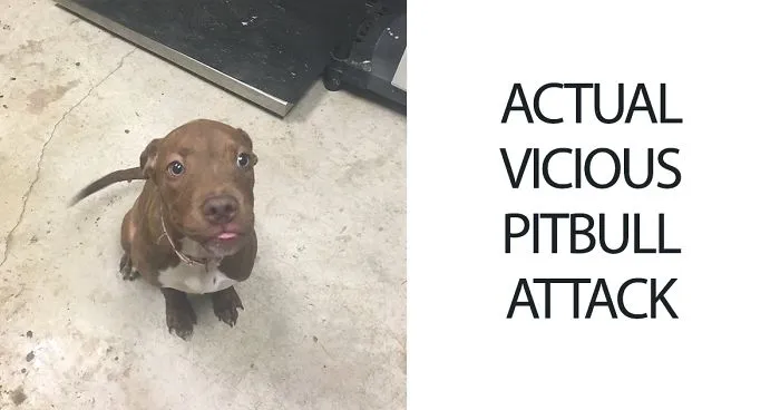 21-Year-Old Inspires People To Share Photos Of "Vicious Pit Bull Attacks", And It's Just Too 'Scary'