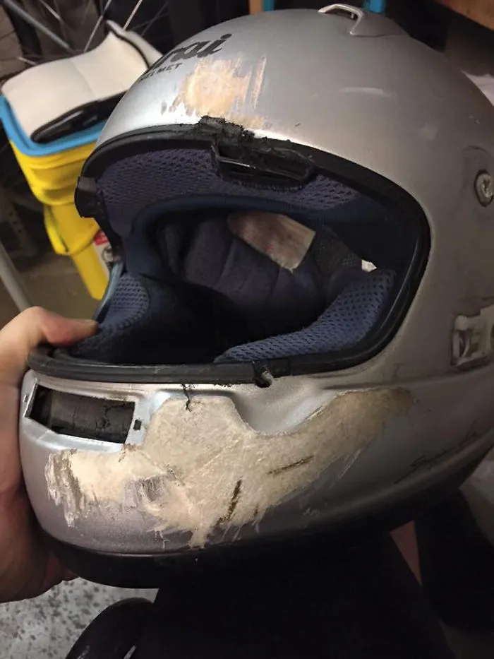 This Is Why You Wear A Full Helmet. My Friend Was Hit By Someone Who Ran A Red Light. If He Had Wore A Skull Cap, He'd Have No Lower Jaw