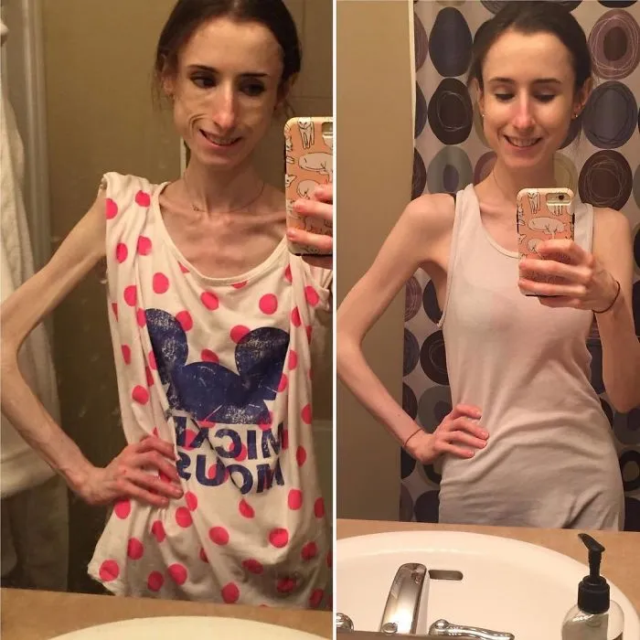 De 27 kilos a 38 en 5 meses y medio