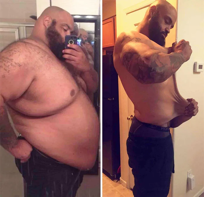 When Told He Would Die If He Didn't Lose Weight, Pat Lost 325 Lbs