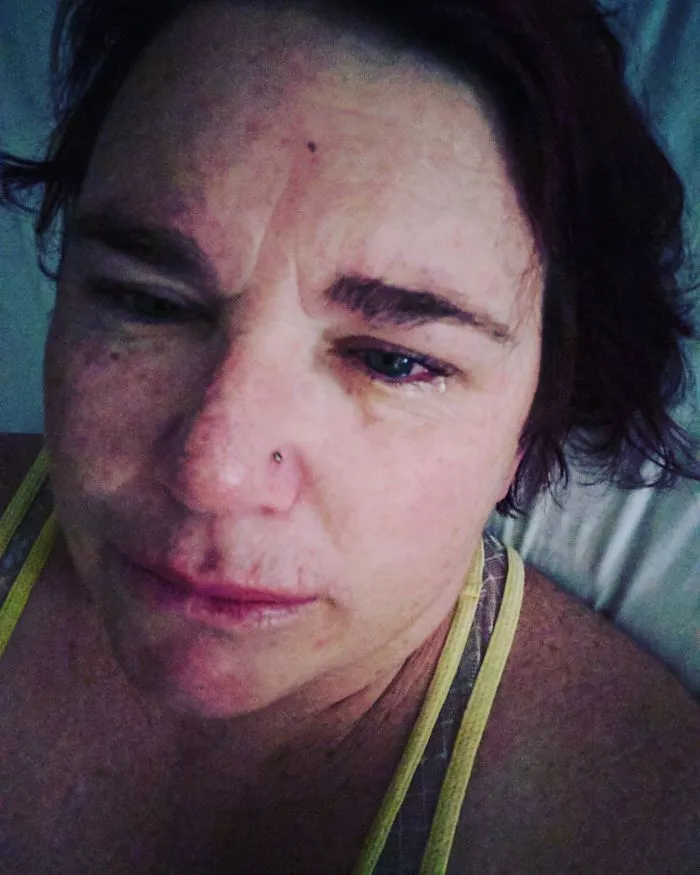 The Face Of Depression And Anxiety