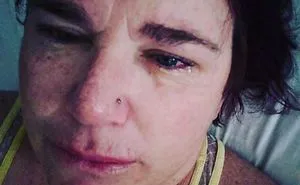 The Face Of Depression And Anxiety