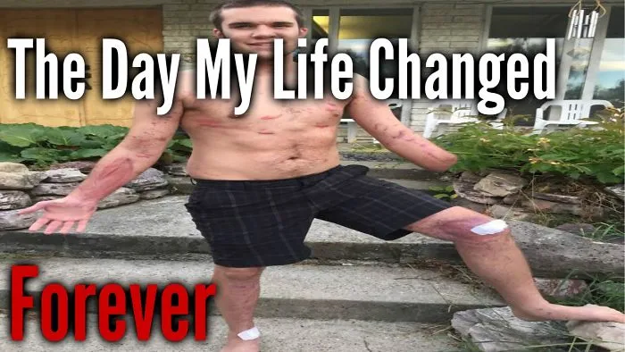 Since Becoming An Amputee, I Spend Hours A Week Creating Motivational Videos To Help Change The World.