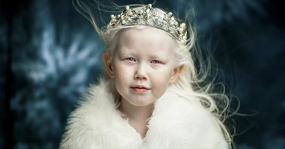Esta "blancanieves siberiana" de 8 años sorprende a las agencias de modelos con su belleza única y recibe un montón de ofertas