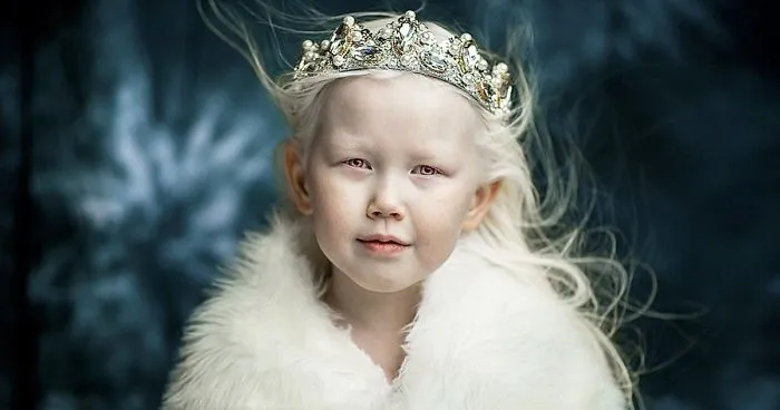 8-Year-Old "Siberian Snow White" Surprises Modeling Agencies With Unique Beauty, Gets Flooded With Offers