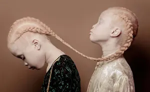 Albino Twins From Brazil Are Taking The Fashion Industry By Storm With Their Unique Beauty