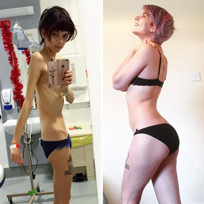 1 año de diferencia. Es posible escapar