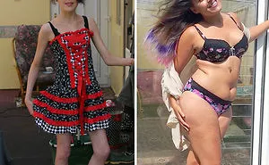 120 Before & After Pics Of People Who Defeated Anorexia