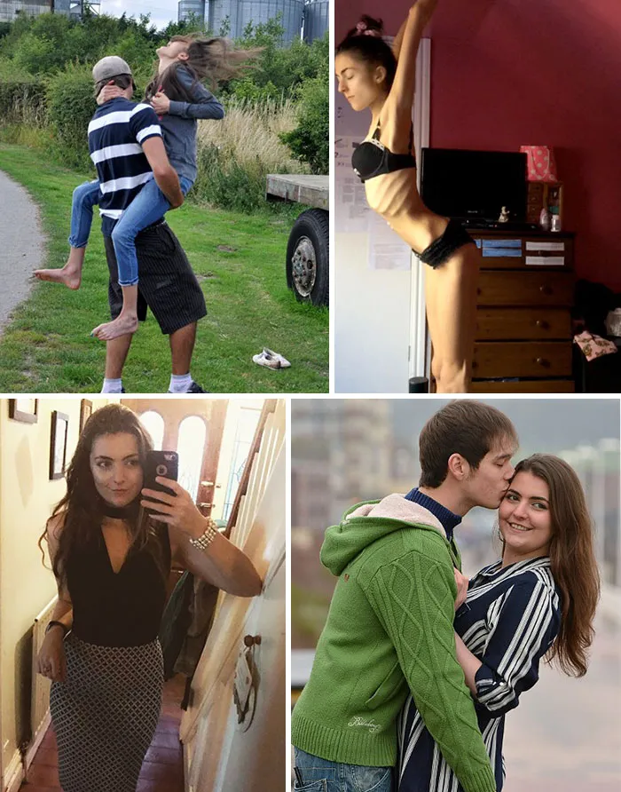Georgia Mcgrath era tan frágil que se le rompieron las costillas al saltar en brazos de su novio, pero se ha recuperado