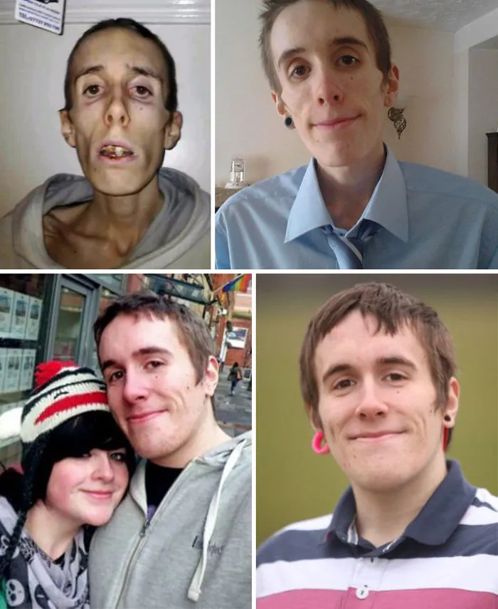 Matthew Booth, estuvo muerto durante 20 minutos cuando lo llevaron al hospital y le salvaron la vida
