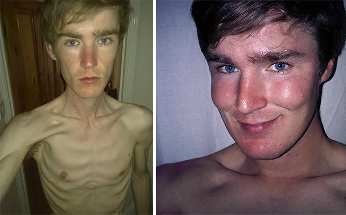 Antes y después