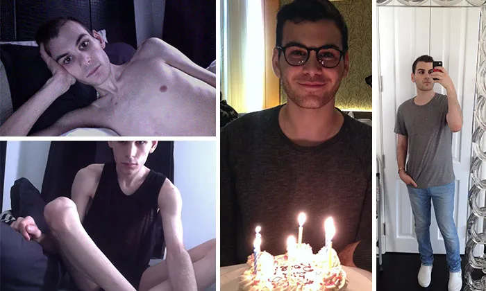 18 meses tras recuperarme de la anorexia