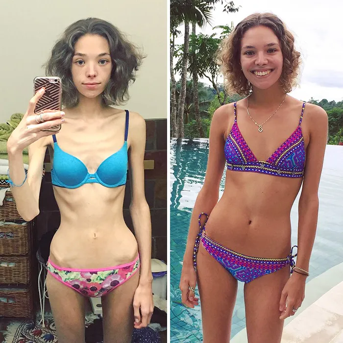 8 meses y 20 kilos después