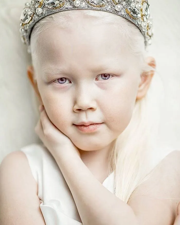 This Adorable Siberian Albino Girl Is Being Nicknamed ‘Snow White’