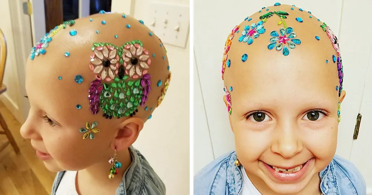 Esta niña de 7 años no permitió que su alopecia le impidiera deslumbrar en la escuela en el día de peinados locos
