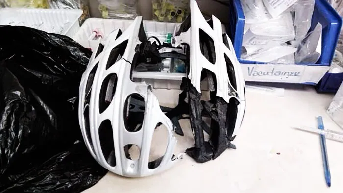 No Doubt This Helmet Saved A Friend From Serious Head Injury Or Death