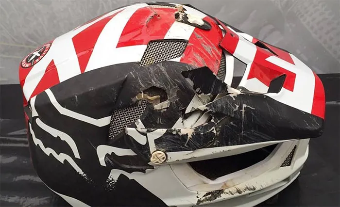 I Really Think Having A Good Helmet Saved My Life