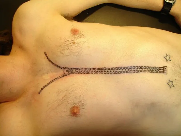 Zipper tattoo design creatively covers a scar on a person's chest.