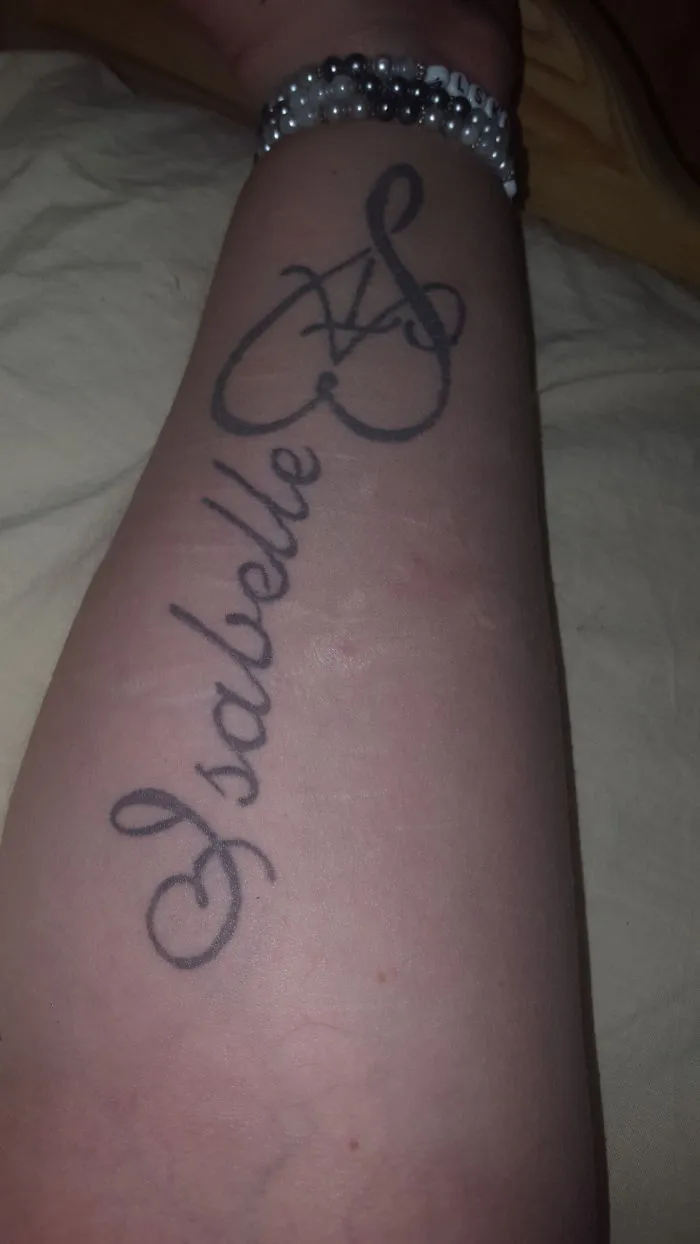 Tattoo on arm creatively transforms a scar into elegant script art.