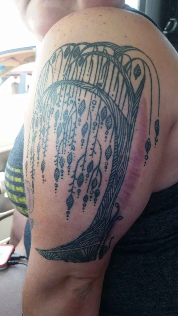 Tattoo of intricate lines and leaves beautifully transforming a scar into art on a person's upper arm.