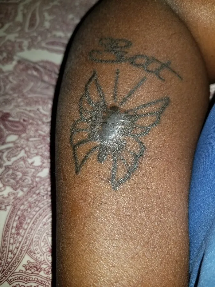 Butterfly tattoo artfully covering a scar on an arm.