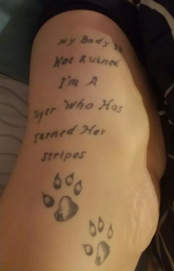 Tattoo turning a scar into art, featuring motivational text and tiger paw prints.